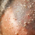 ein dermatologe erklärt die wahren ursachen von juckender kopfhaut und warum es meist nicht nur an schuppen liegt.